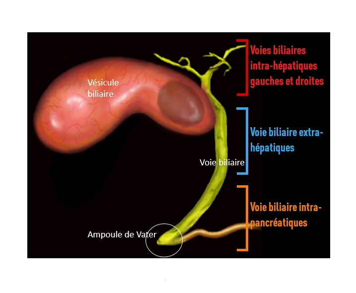Voies biliaires - IRA II