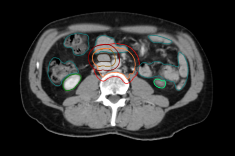 testis.png